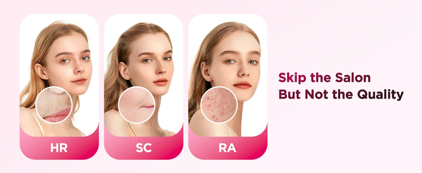 Épilateur laser IPL avec refroidissement par glace