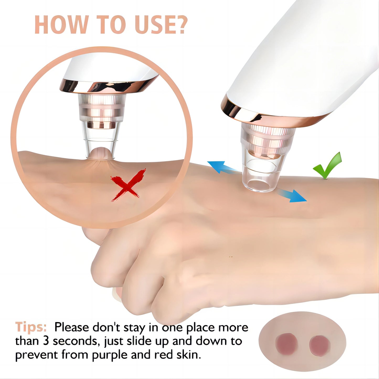 Microdermabrasion facial - Techni Tendresse