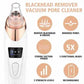 Microdermabrasion facial - Techni Tendresse