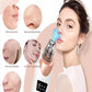 Microdermabrasion facial - Techni Tendresse