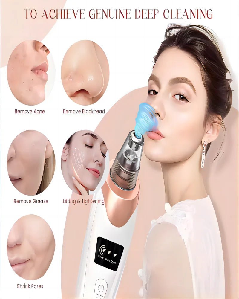 Microdermabrasion facial - Techni Tendresse